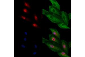 ABIN7094659 and ABIN7098710 staining  cells by IF/ICC. (TCF21 Antikörper  (Internal Region))