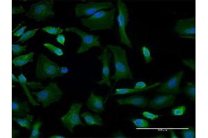 Immunofluorescence (IF) image for anti-Golgi Brefeldin A Resistant Guanine Nucleotide Exchange Factor 1 (GBF1) (AA 101-209) antibody (ABIN948729)