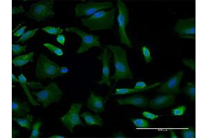 Immunofluorescence of monoclonal antibody to GBF1 on HeLa cell. (GBF1 Antikörper  (AA 101-209))