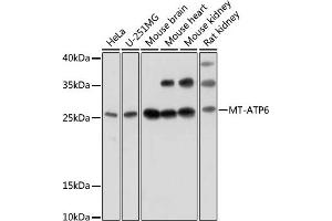 Western blot analysis of extracts of various cell lines, using MT- antibody (ABIN7268592) at 1:1000 dilution. (MT-ATP6 Antikörper)