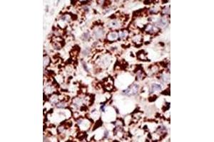 Image no. 2 for anti-GPI-anchor transamidase (GPI8) (C-Term) antibody (ABIN357726) (PIGK Antikörper  (C-Term))