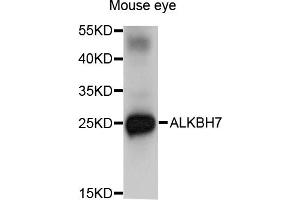Western blot analysis of extracts of mouse eye, using ALKBH7 antibody (ABIN5971299) at 1/1000 dilution. (ALKBH7 Antikörper)
