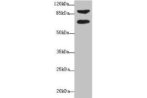 Western blot All lanes: DTX2 antibody at 1 μg/mL + HepG2 whole cell lysate Secondary Goat polyclonal to rabbit IgG at 1/10000 dilution Predicted band size: 68, 63 kDa Observed band size: 68, 92 kDa (DTX2 Antikörper  (AA 1-280))