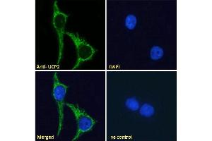 Immunofluorescence (IF) image for anti-Uncoupling Protein 2 (Mitochondrial, Proton Carrier) (UCP2) (Internal Region) antibody (ABIN5539644)