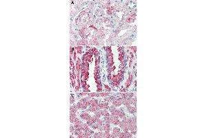 Immunohistochemical staining of formalin-fixed, paraffin-embedded human kidney (A), human prostate (B) and human liver (C) tissue after heat-induced antigen retrieval. (GPR146 Antikörper  (Internal Region))