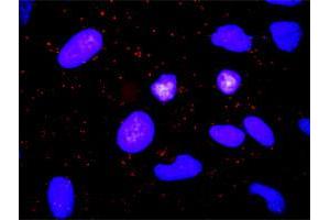 Proximity Ligation Assay (PLA) image for anti-ADAM Metallopeptidase Domain 17 (ADAM17) (AA 215-314) antibody (ABIN563080)