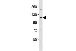 Western blot testing of Notch1 antibody at 1:2000 dilution + mouse lung lysate (Notch1 Antikörper  (C-Term))