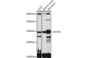 Western blot analysis of extracts of various cell lines, using SYCP2 antibody (ABIN7270668) at 1:1000 dilution. (SYCP2 Antikörper  (AA 1231-1530))