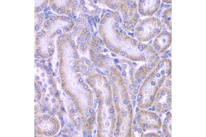 Immunohistochemistry of paraffin-embedded rat kidney using ACAA1 antibody (ABIN4902819) at dilution of 1:100 (40x lens).