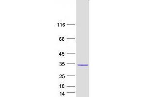 Validation with Western Blot