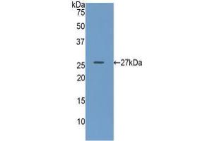 Western blot analysis of recombinant Human GUSb. (Glucuronidase beta Antikörper  (AA 451-649))