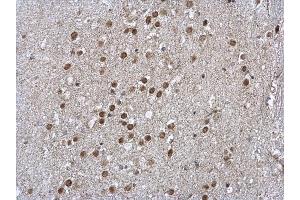 Immunohistochemistry (IHC) image for anti-LIM Domains Containing 1 (LIMD1) (C-Term) antibody (ABIN2856419)
