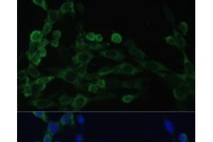 Immunofluorescence analysis of NIH/3T3 cells using EEF1B2 Polyclonal Antibody at dilution of 1:100. (EEF1B2 Antikörper)