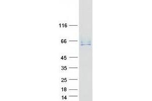 Validation with Western Blot (ANTXR2 Protein (Transcript Variant 2) (Myc-DYKDDDDK Tag))