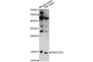 Western blot analysis of extracts of various cell lines, using FAM127A antibody.