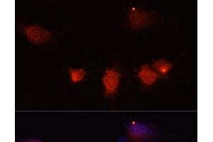 Immunofluorescence analysis of U-251MG cells using NPY Polyclonal Antibody at dilution of 1:100 (40x lens). (NPY Antikörper)