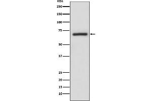 Western blot analysis of A-RAF expression in A375 cell lysate.
