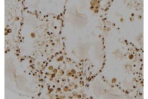 ABIN6264614 and ABIN6277485 at 1/100 staining Human lung tissue by IHC-P. (RAD23A Antikörper  (C-Term))