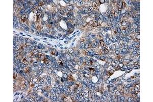 Immunohistochemical staining of paraffin-embedded Kidney tissue using anti-SIL1 mouse monoclonal antibody. (SIL1 Antikörper)