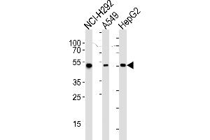 Western blot analysis of lysates from NCI-, A549, HepG2 cell line (from left to right), using ALDH2 Antibody (ABIN658993 and ABIN2838036). (ALDH2 Antikörper)
