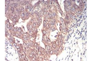Immunohistochemistry (IHC) image for anti-Emerin (EMD) (AA 1-222) antibody (ABIN5864847) (Emerin Antikörper  (AA 1-222))