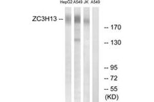Western blot analysis of extracts from A549/Jurkat/HepG2 cells, using ZC3H13 Antibody. (ZC3H13 Antikörper  (AA 1571-1620))