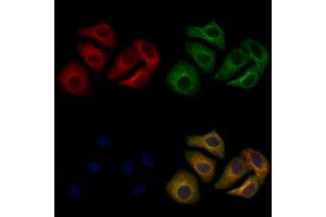 ABIN6260986 and ABIN6266876 staining Hela cells by IF/ICC.