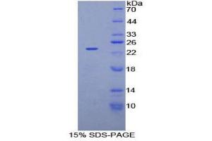 SDS-PAGE (SDS) image for NME/NM23 Nucleoside Diphosphate Kinase 3 (NME3) (AA 1-168) protein (His tag) (ABIN1878101)
