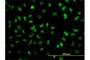 Immunofluorescence (IF) image for anti-Snail Family Zinc Finger 2 (SNAI2) (AA 97-169) antibody (ABIN520274)