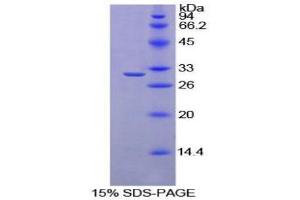 SDS-PAGE (SDS) image for Ribonuclease/angiogenin Inhibitor 1 (RNH1) (AA 108-358) protein (His tag) (ABIN1879328) (RNH1 Protein (AA 108-358) (His tag))