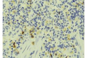 ABIN6273242 at 1/100 staining Human lymph tissue by IHC-P. (FAM65B Antikörper)