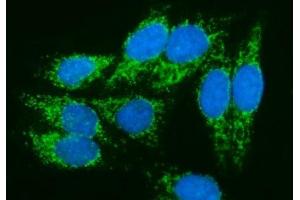 IF analysis of PMPCA/INPP5 using anti-PMPCA/INPP5 antibody (ABIN7602722). (PMPCA Antikörper  (AA 99-525))