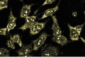 Immunofluorescence staining of HeLa cells (Human cervical epitheloid carcinoma, ATCC CCL-2. (BDKRB2 Antikörper  (AA 350-364))