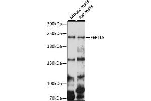 Western blot analysis of extracts of various cell lines, using FER1L5 antibody (ABIN7267166) at 1000 dilution. (FER1L5 Antikörper  (AA 1350-1670))