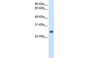 GGTLC1 Antikörper  (C-Term)