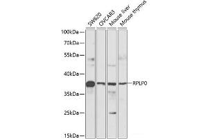 Western blot analysis of extracts of various cell lines using RPLP0 Polyclonal Antibody at dilution of 1:1000. (RPLP0 Antikörper)