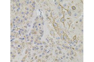 Immunohistochemistry of paraffin-embedded Mouse brain using REG3A Polyclonal Antibody (REG3A Antikörper)