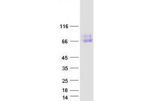 Validation with Western Blot