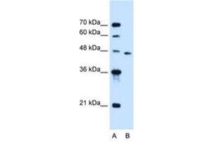 Image no. 1 for anti-Solute Carrier Family 16, Member 12 (Monocarboxylic Acid Transporter 12) (SLC16A12) (AA 49-98) antibody (ABIN6736666) (SLC16A12 Antikörper  (AA 49-98))