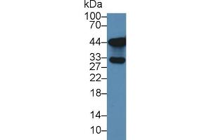 Western blot analysis of Human Lung lysate, using Human TKA1 Antibody (3 µg/ml) and HRP-conjugated Goat Anti-Rabbit antibody ( (SLC9A3R2 Antikörper  (AA 56-337))