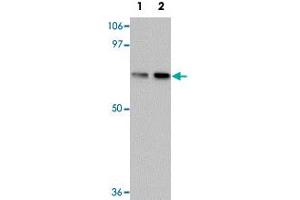 Western blot analysis of TCTN1 in mouse kidney tissue lysate with TCTN1 polyclonal antibody  at (1) 1 and (2) 2ug/mL.