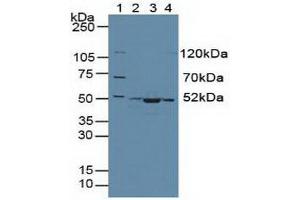 Western blot analysis of (1) Human 293T Cells, (2) Human HeLa cells, (3) Mouse Skeletal Muscle Tissue and (4) Human HepG2 Cells. (CS Antikörper  (AA 174-428))