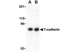Western Blotting (WB) image for anti-Cadherin 13 (CDH13) (N-Term) antibody (ABIN2477830)