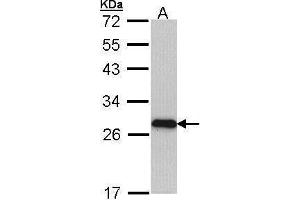 WB Image Sample (30 ug of whole cell lysate) A: Molt-4 , 12% SDS PAGE antibody diluted at 1:1000 (MYL3/CMLC1 Antikörper)