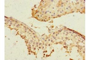 Immunohistochemistry of paraffin-embedded human testis tissue using ABIN7169162 at dilution of 1:100 (PLK3 Antikörper  (AA 487-646))