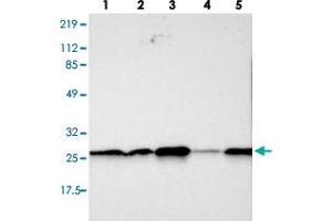 Western blot analysis of lane 1: RT-4, lane 2: U-251 MG, lane 3: A-431, lane 4: Liver and lane 5: Tonsil using SNAP23 polyclonal antibody . (SNAP23 Antikörper)