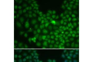 Immunofluorescence analysis of U2OS cells using CLU Polyclonal Antibody (Clusterin Antikörper)