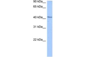 Western Blotting (WB) image for anti-DCP2 Decapping Enzyme Homolog (DCP2) antibody (ABIN2462345) (DCP2 Antikörper)