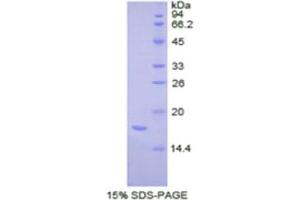 SDS-PAGE analysis of Human Complexin 2 Protein.