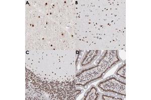 Immunohistochemical staining (Formalin-fixed paraffin-embedded sections) of human cerebral cortex (A, B), human cerebellum (C) and human duodenum (D) with ZNF3 polyclonal antibody . (ZNF3 Antikörper)